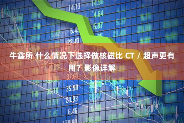 牛鑫所 什么情况下选择做核磁比 CT / 超声更有用？影像详解
